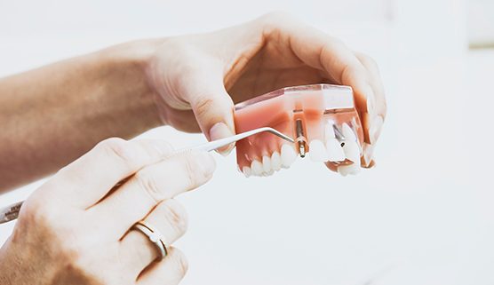 dental-checkups